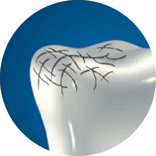 Dente trattato con Biorepair