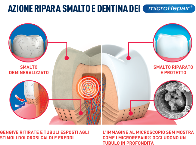 azione ripara smalto e dentina dei microrepair