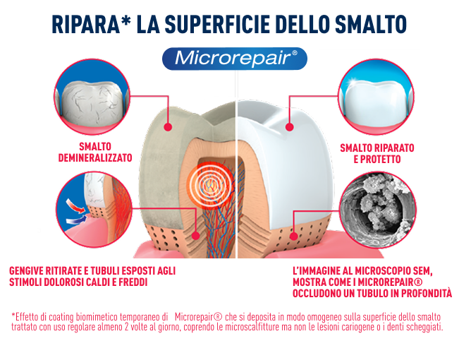azione ripara smalto e dentina dei microrepair