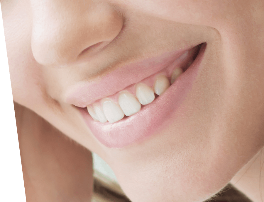 sorriso ragazza